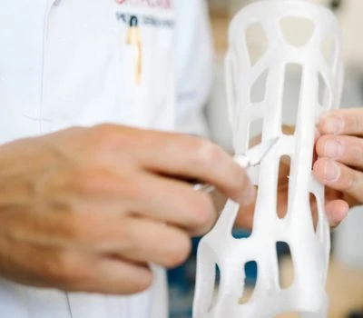 STL-tiedostomuotojen vienti 3D-tulostettua ortoosia varten: kuinka 3D-jalkaskannaus muuttaa biome...