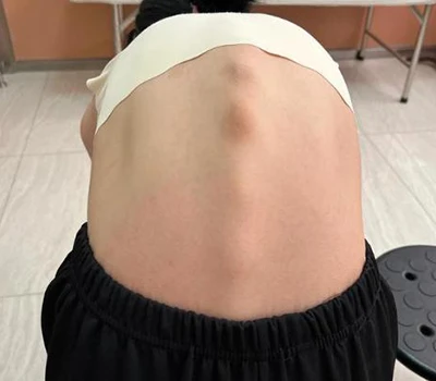 Mullistava selkäydinterveys: Xianku 3D Body Scanner